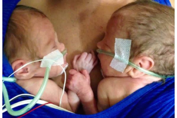 NICU Story - Babies Holding Hands After A Month of Being Apart