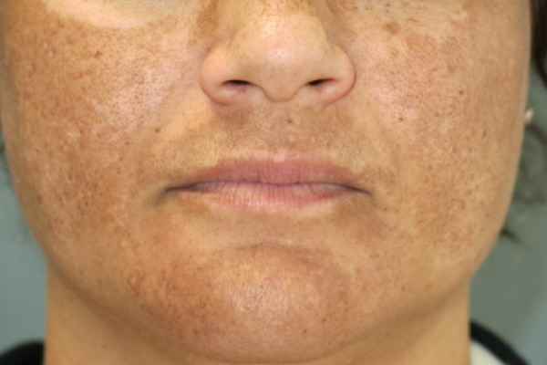 Screen Shot 2017-07-12 at 2.26.11 PM